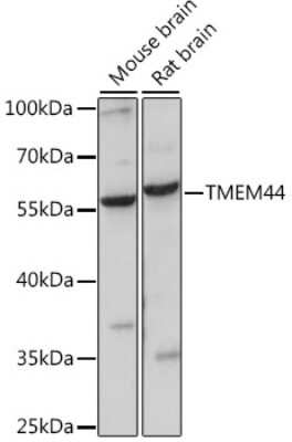 Western Blot: TMEM44 AntibodyAzide and BSA Free [NBP2-94005]