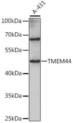 Western Blot: TMEM44 AntibodyAzide and BSA Free [NBP2-94429]