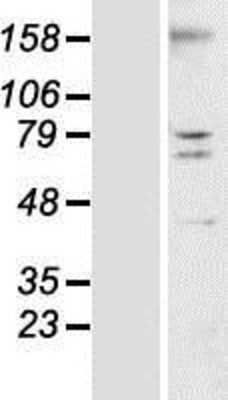 Western Blot: TMEM44 Overexpression Lysate [NBP2-08784]