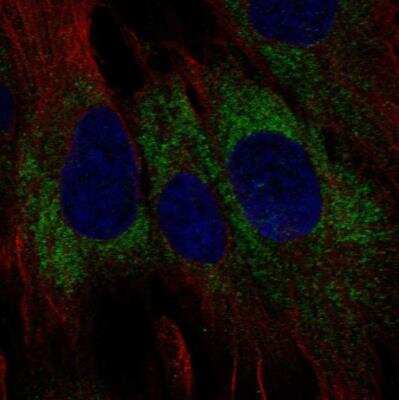 Immunocytochemistry/ Immunofluorescence: TMEM45A Antibody [NBP2-49355]