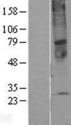 Western Blot: TMEM45A Overexpression Lysate [NBL1-17082]