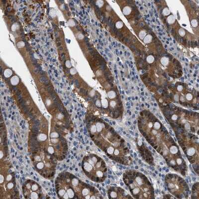 Immunohistochemistry-Paraffin: TMEM45B Antibody [NBP1-88686]