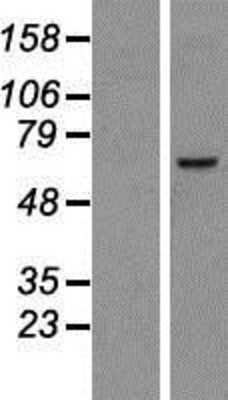 Western Blot: TMEM48 Overexpression Lysate [NBP2-06877]