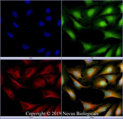 Immunocytochemistry/ Immunofluorescence: TMEM49 Antibody - BSA Free [NBP2-78784]