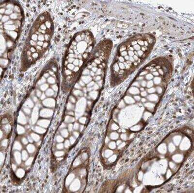 Immunohistochemistry-Paraffin: TMEM49 Antibody [NBP1-83971]