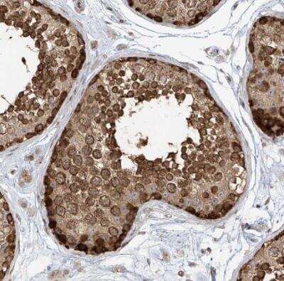 Immunohistochemistry-Paraffin: TMEM49 Antibody [NBP1-83971]