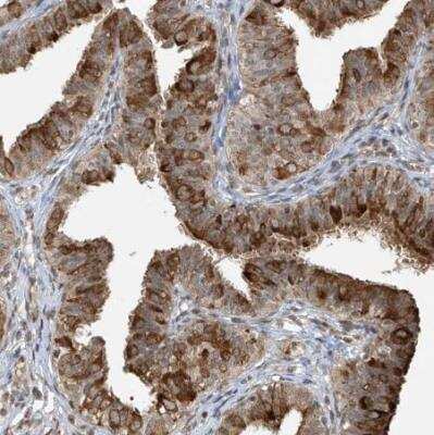 Immunohistochemistry-Paraffin: TMEM49 Antibody [NBP1-83971]