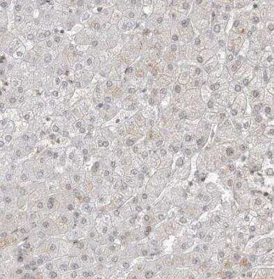 Immunohistochemistry-Paraffin: TMEM49 Antibody [NBP1-83971]