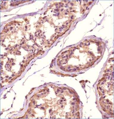 Immunohistochemistry-Paraffin: TMEM49 Antibody - BSA Free [NBP2-78784]