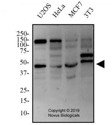 Western Blot: TMEM49 AntibodyBSA Free [NBP2-78784]