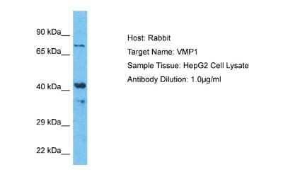 Western Blot: TMEM49 Antibody [NBP2-88441]