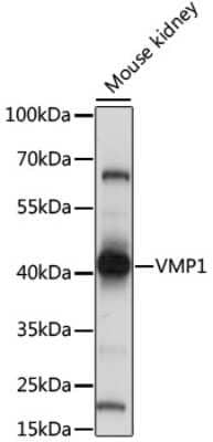 Western Blot: TMEM49 AntibodyAzide and BSA Free [NBP2-93149]