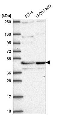 Western Blot: TMEM5 Antibody [NBP2-56655]