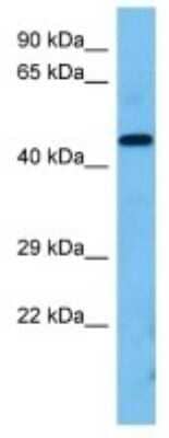 Western Blot: TMEM5 Antibody [NBP3-10144]