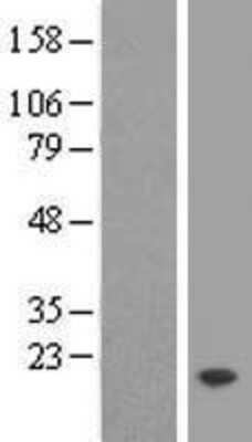 Western Blot: TMEM50B Overexpression Lysate [NBL1-17087]