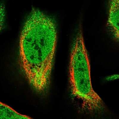 Immunocytochemistry/ Immunofluorescence: TMEM51 Antibody [NBP2-55450]