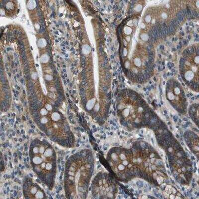 Immunohistochemistry-Paraffin: TMEM51 Antibody [NBP1-88326]