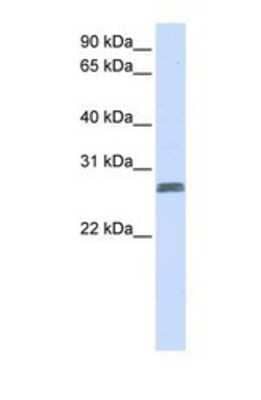 Western Blot: TMEM51 Antibody [NBP1-69597]