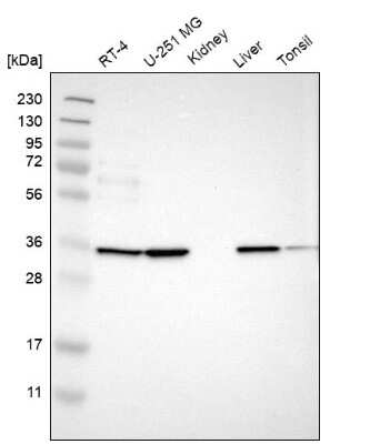 Western Blot: TMEM51 Antibody [NBP1-88326]