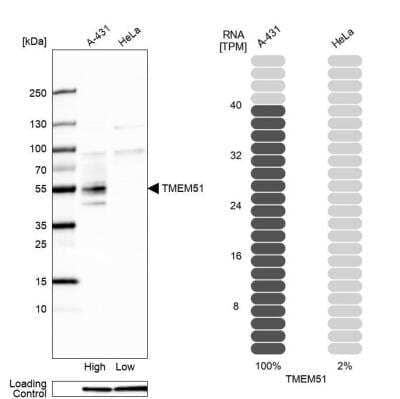 Western Blot: TMEM51 Antibody [NBP2-55450]