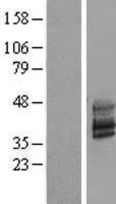 Western Blot: TMEM51 Overexpression Lysate [NBP2-09611]