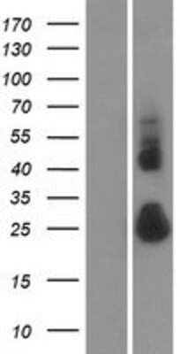 Western Blot: TMEM52 Overexpression Lysate [NBP2-04961]