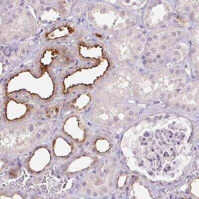 Immunohistochemistry-Paraffin: TMEM52B Antibody [NBP2-49272]