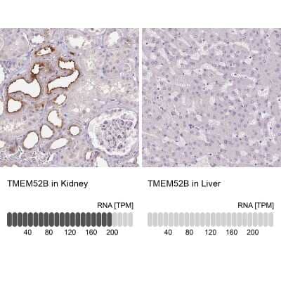 Immunohistochemistry-Paraffin: TMEM52B Antibody [NBP2-49272]