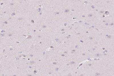 Immunohistochemistry-Paraffin: TMEM52B Antibody [NBP2-49272]