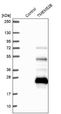 Western Blot: TMEM52B Antibody [NBP2-49272]