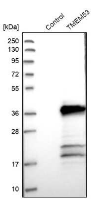 Western Blot: TMEM53 Antibody [NBP1-82124]