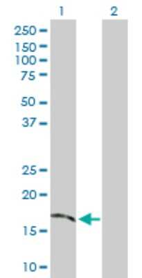 Western Blot: TMEM54 Antibody [H00113452-D01P]