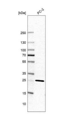 Western Blot: TMEM55B Antibody [NBP2-13453]