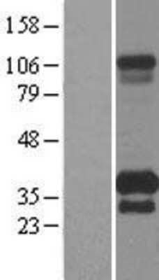 Western Blot: TMEM55B Overexpression Lysate [NBL1-17091]