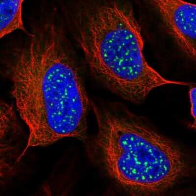 Immunocytochemistry/ Immunofluorescence: TMEM56 Antibody [NBP2-33470]