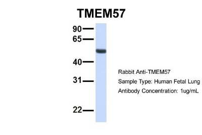 Western Blot: TMEM57 Antibody [NBP1-59709]