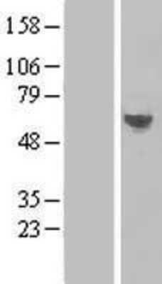 Western Blot: TMEM57 Overexpression Lysate [NBL1-17092]