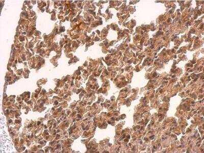 Immunohistochemistry-Paraffin: TMEM59 Antibody [NBP1-32303]