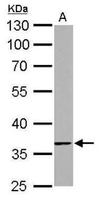 Western Blot: TMEM59 Antibody [NBP1-32303]