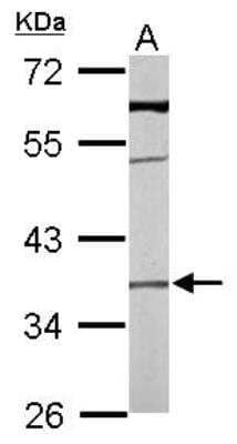 Western Blot: TMEM59 Antibody [NBP1-32303]