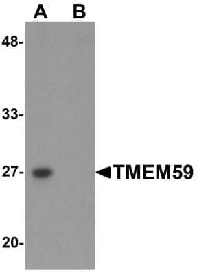 Western Blot: TMEM59 AntibodyBSA Free [NBP1-76497]