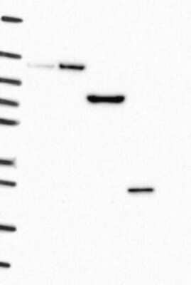 Western Blot: TMEM59 Antibody [NBP3-17950]