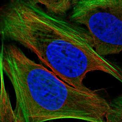 Immunocytochemistry/ Immunofluorescence: TMEM59L Antibody [NBP2-57421]