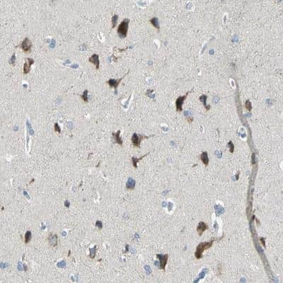 Immunohistochemistry: TMEM59L Antibody [NBP1-88500]