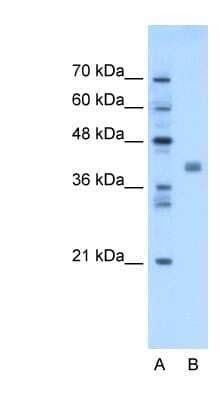 Western Blot: TMEM59L Antibody [NBP1-62564]