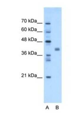 Western Blot: TMEM59L Antibody [NBP1-69576]