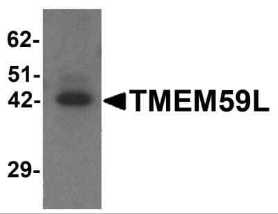 Western Blot: TMEM59L AntibodyBSA Free [NBP2-81937]