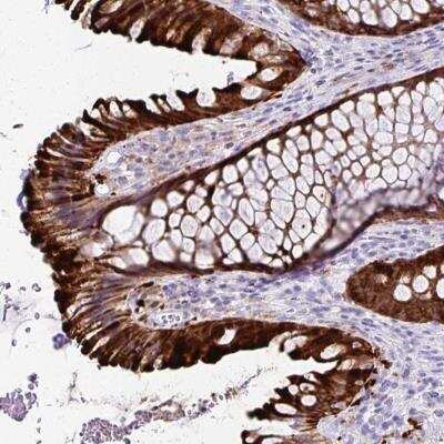 Immunohistochemistry-Paraffin: TMEM60 Antibody [NBP2-31862]