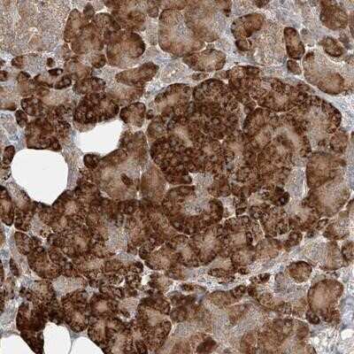 Immunohistochemistry-Paraffin: TMEM61 Antibody [NBP1-91021]