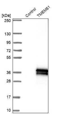 Western Blot: TMEM61 Antibody [NBP1-91021]